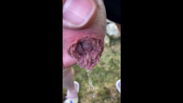 Public Pissing with Fat Foreskin in Park