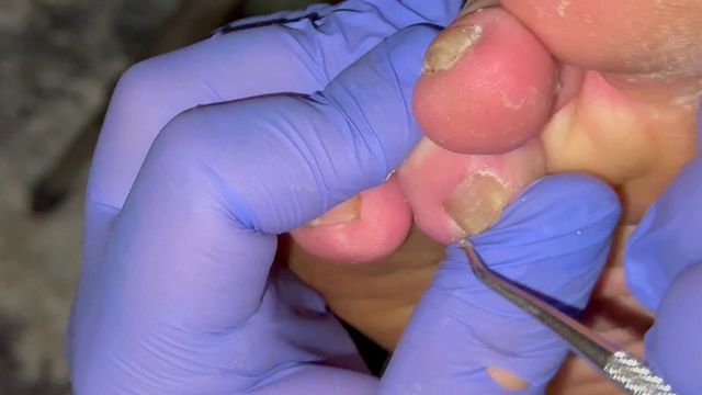Ugly Feet Pedicure ASMR