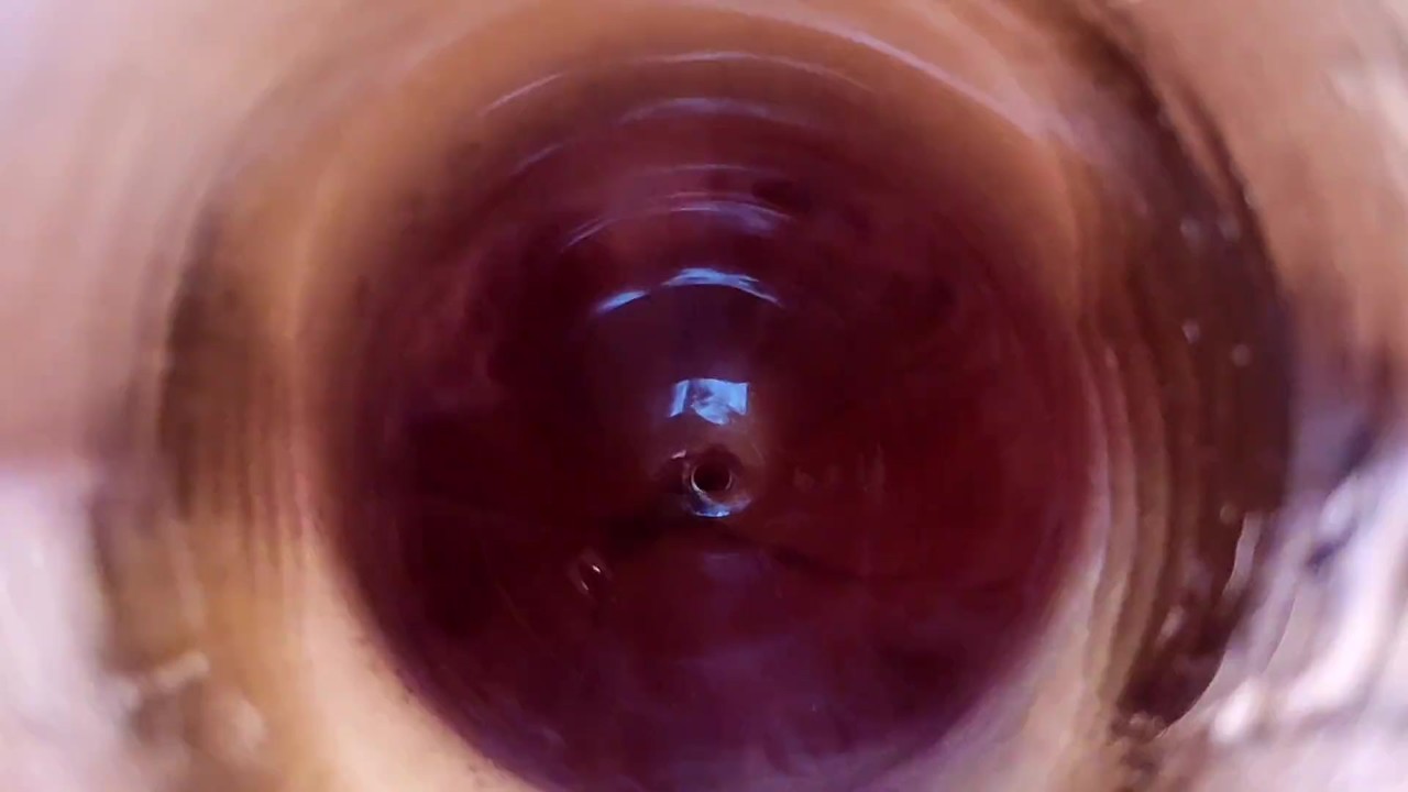 Lucky Bottom Gets Anal Fucked with Peniscope