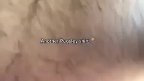 Hairy Bear Shows Off Belly