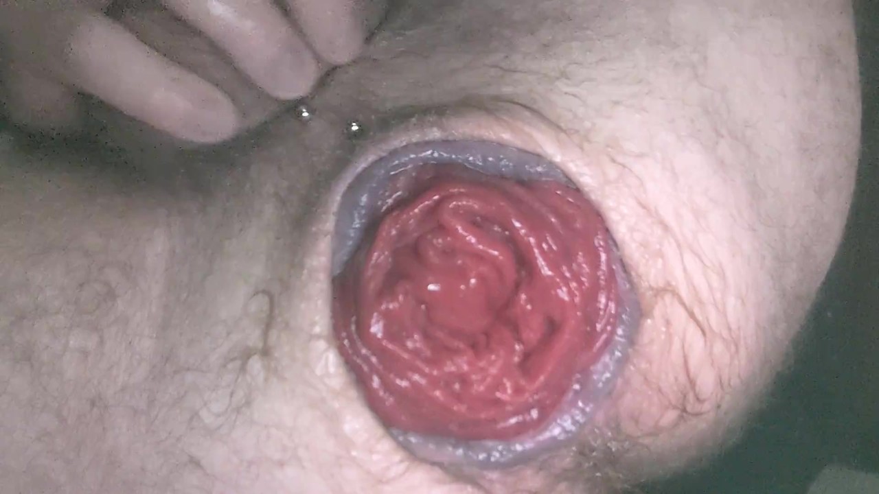 Rosebud Anal Stretching with Intense Ass Play