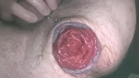 Rosebud Anal Stretching with Intense Ass Play