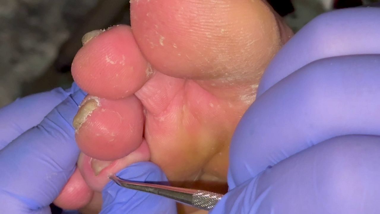Ugly Feet Pedicure ASMR